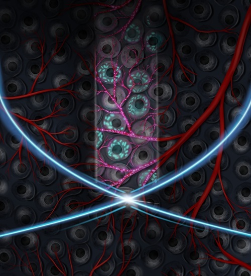 Imagen: impresión artística de la nueva técnica de ultrasonido, llamada microscopía de lámina sonora no lineal (foto cortesía de Maayan Harel/Maresca Lab)